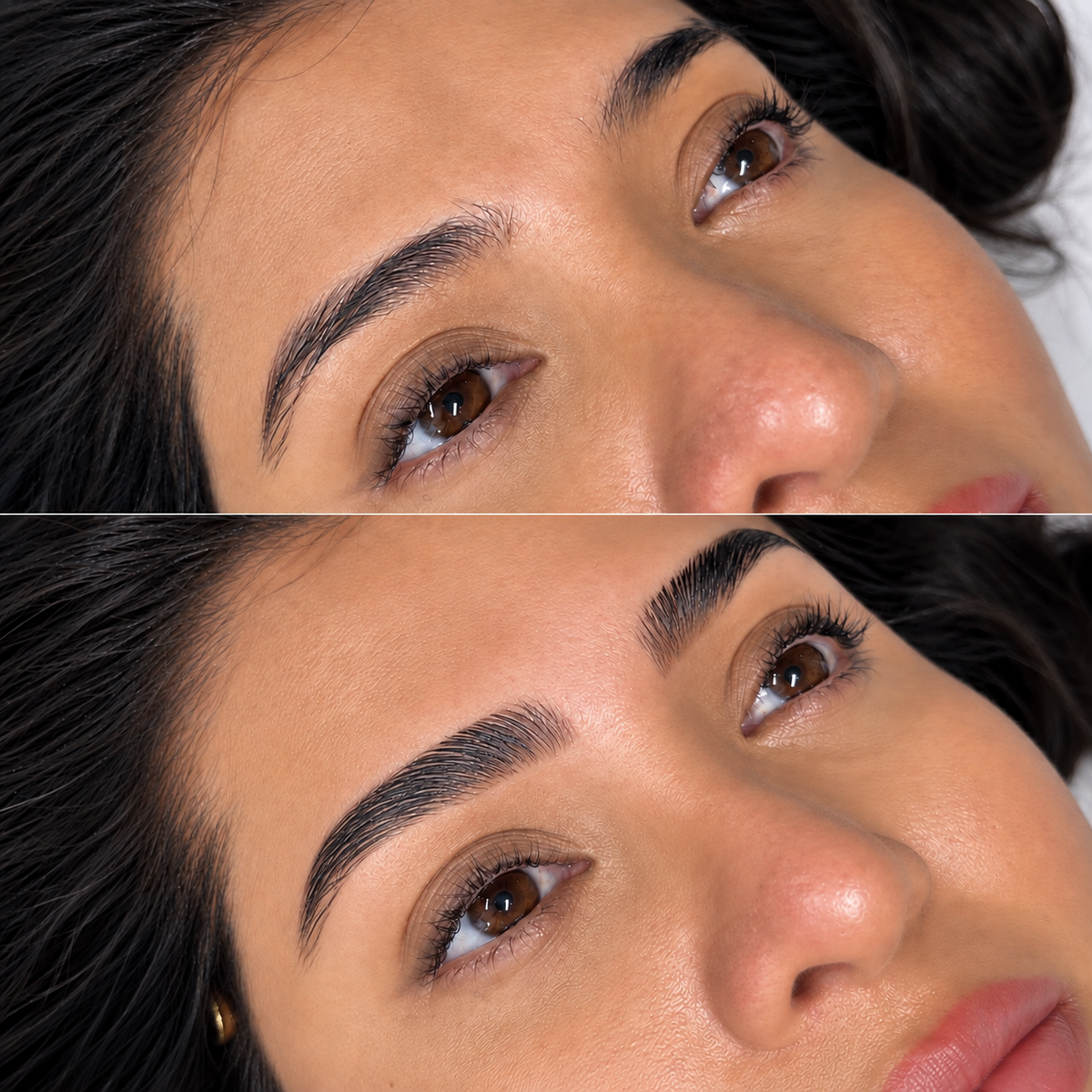 Brow Consultation